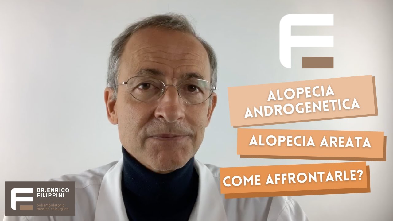 Alopecia nella donna come si manifesta e come si cura e come si previene.