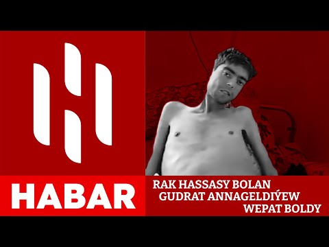 Türkmenistanda Rak Hassasy Bolan Gudrat Annageldiýew Wepat Boldy