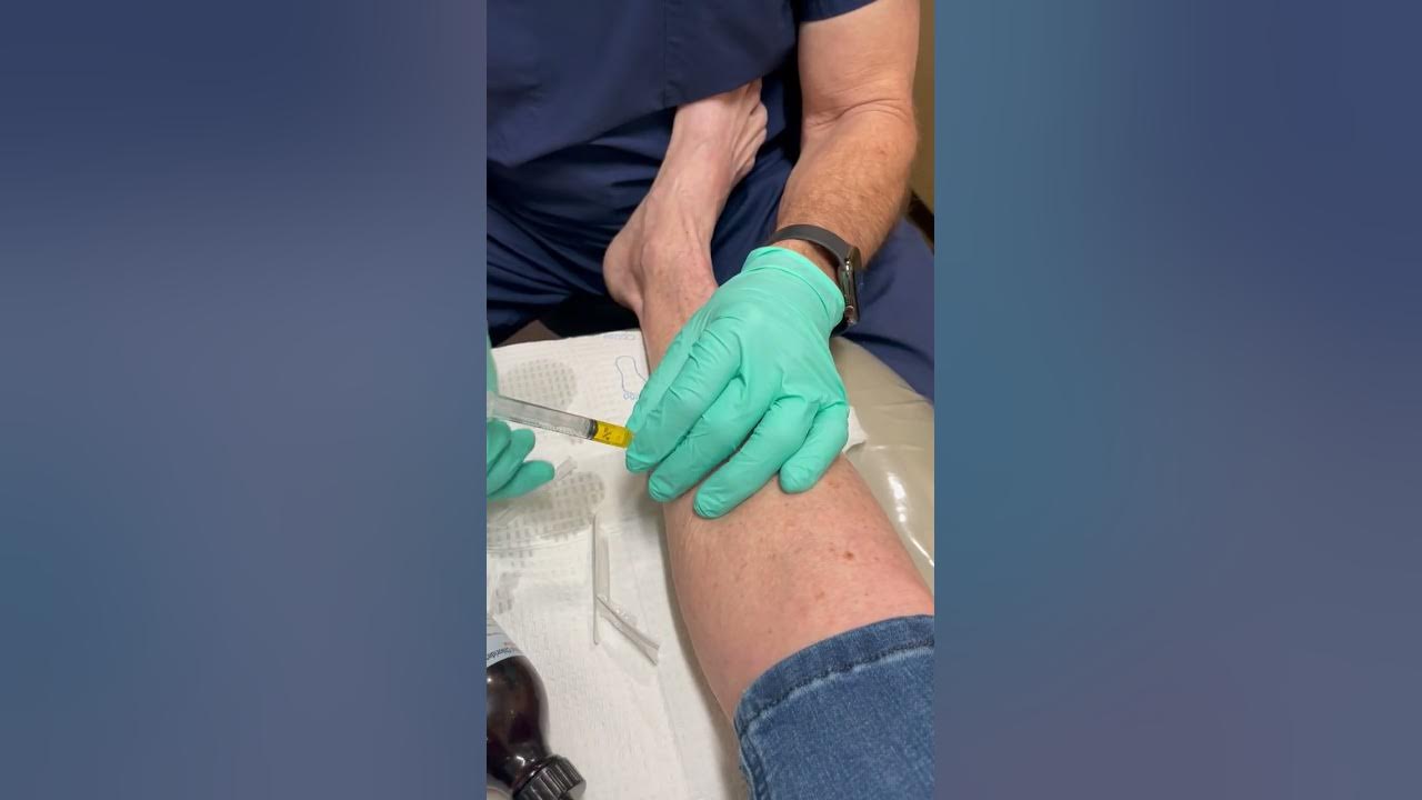 Neuropathy Treatment with B Complex Lower Extremity Injection YouTube