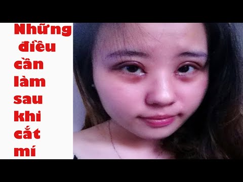 Video: Làm Gì Khi Cắt