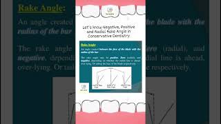 Let's know Negative, Positive and Radial Rake Angle in Cons #conservative #dentistry #dental #bds