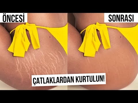 ÇATLAKLARDAN NASIL KURTULDUM ?  (Ev Yapımı 6 Doğal Çözüm)