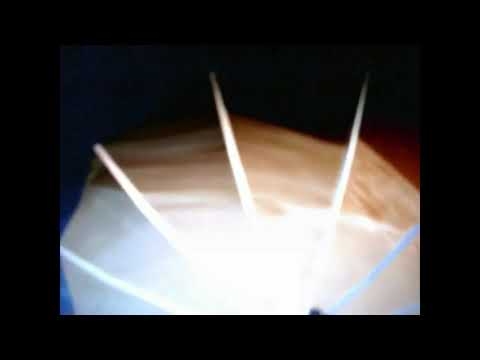 apollo 20 completo