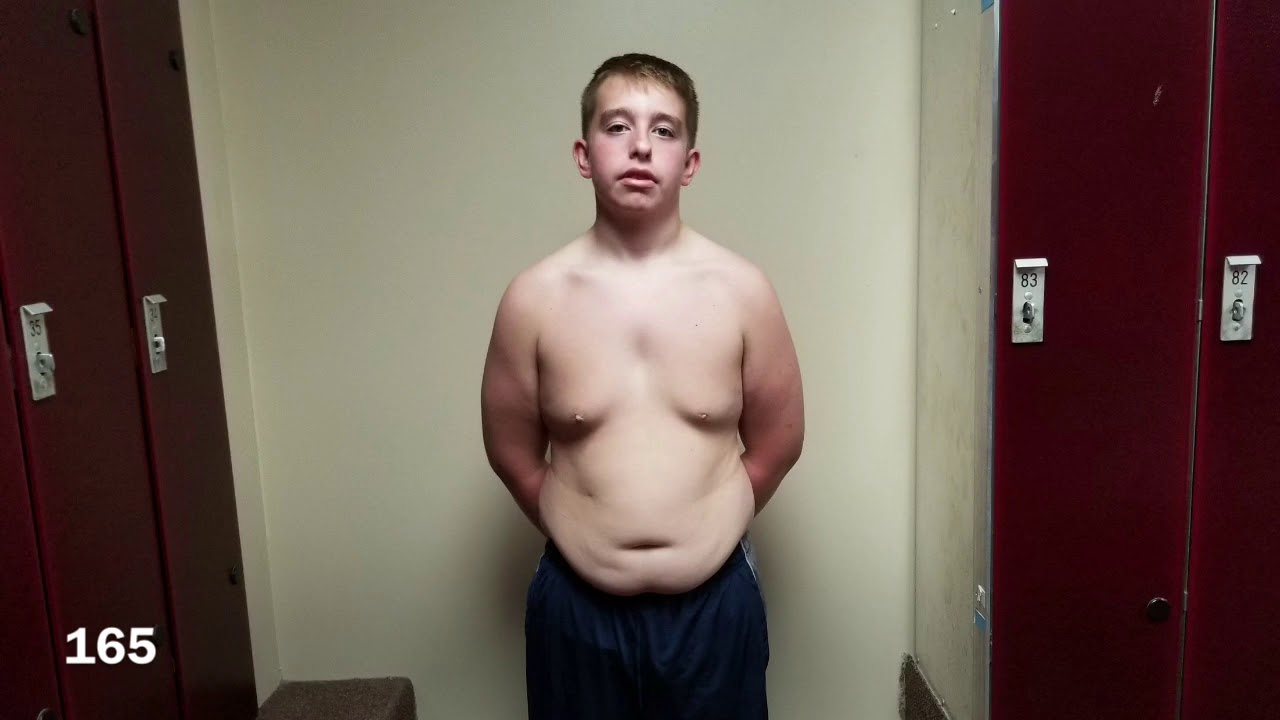 14 Years Old 70Lbs Weight Loss Transformation