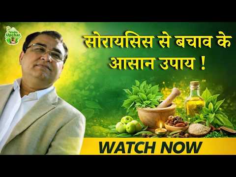 How to Manage Psoriasis Naturally? Important Tips | Vedic Upchar | #psoriasis #skin #video #tips