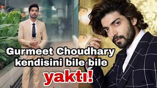 Gurmeet Choudhary Kendisini Bile Bile Yaktı