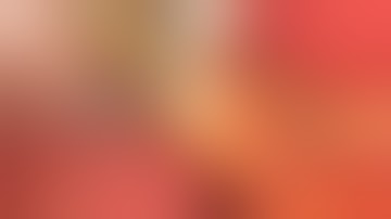 Laparoscopic Cholecystectomy with Cholangioghraphy