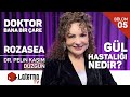 Gl hastal rozasea nedir  doktor bana bir are  dr pelin kasm dzgn