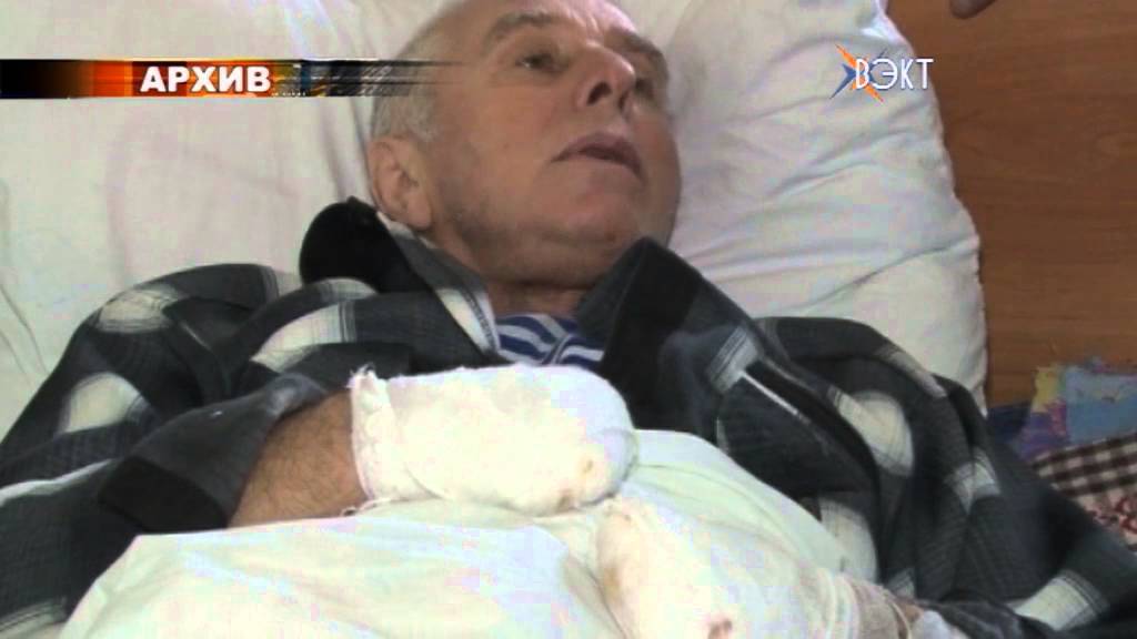 6 случаев обморожения. Как не стать жертвой холодов?