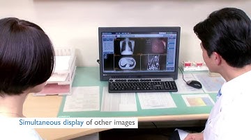 ImagePilot    AeroDR all in one DR solution