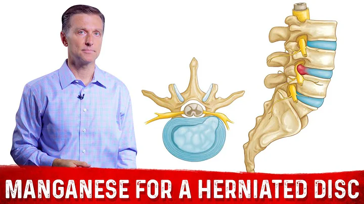 Take Manganese for Herniated Disc & Strengthening Ligaments – Dr.Berg