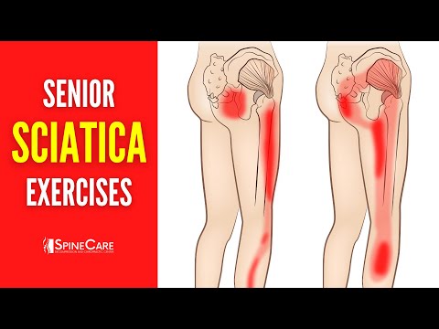 Replying to @ladycarolinachs Sciatic nerve pain #fyp #sciaticnerve #s, sciatica  pain relief