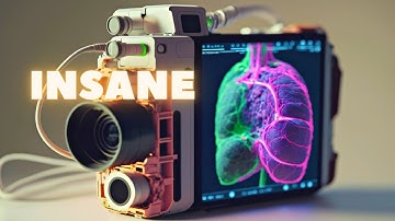 These 3D Cameras Protect Cancer Patients | SGRT