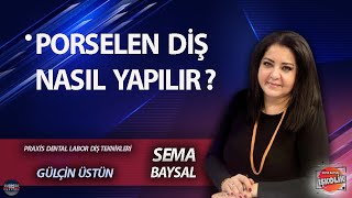 Sema Baysal Ile İşkoli̇k L Gülçi̇n Üstün Porselen Di̇ş Nasil Yapilir ?