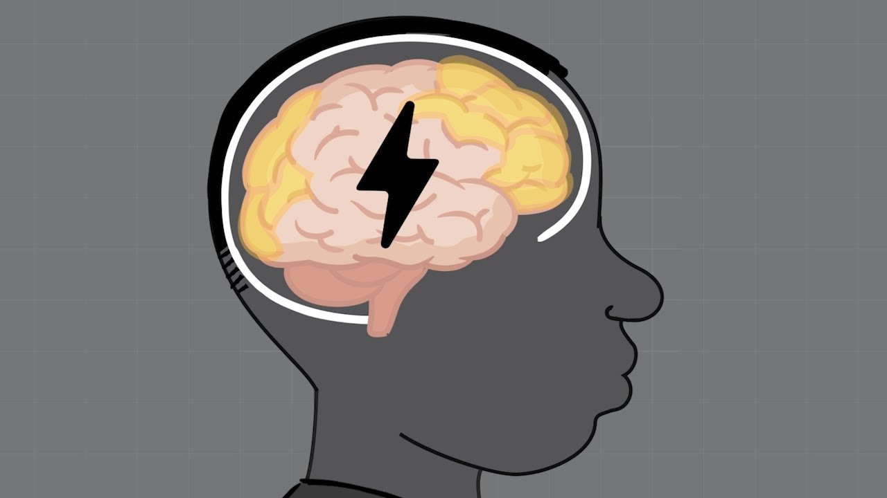 HEADS UP to Sports Officials: Concussion Basics - YouTube