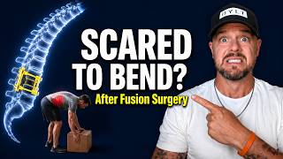 Information Afraid to Bend After Spinal Fusion Here's How Fix It Fast! Guide