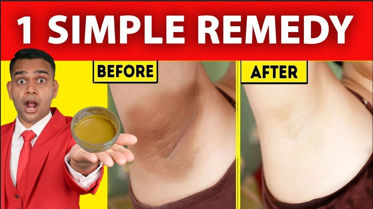 1 Simple Remedy For Dark Armpit, Black Neck, Black elbows and knees - Dr. Vivek Joshi