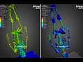Biomechanics FEA Simulation of Human Skeleton Dropped From 2 Meters Height - ANSYS Explicit Dynamics