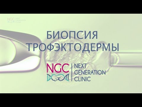 Биопсия трофэктодермы в