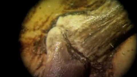 The Link - Darwinius Masillae - Ida (03 of 30) ORKUT Community and Profile