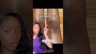 The ultimate combo to fade body hyperpigmentation #bodycare #skincare
