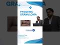 Pyogenic Granuloma #cystpoping #granuloma#surgerysuccess #bestsurgeon#cyst