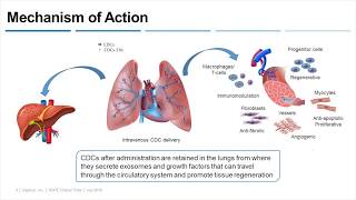 [Webinar] HOPE-2 Duchenne Clinical Trial – Capricor – July 2018
