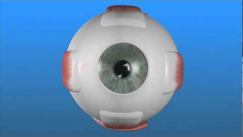 Refractive Errors