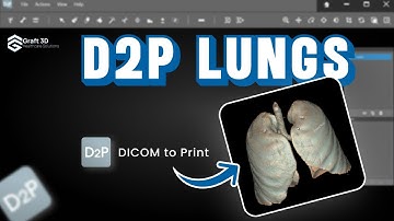 Segmentation of Lungs from CT DICOM Data Using D2P