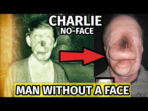 Video: Pennsylvanian Legend Of Faceless Charlie, Som Visade Sig Vara Sant - Alternativ Vy