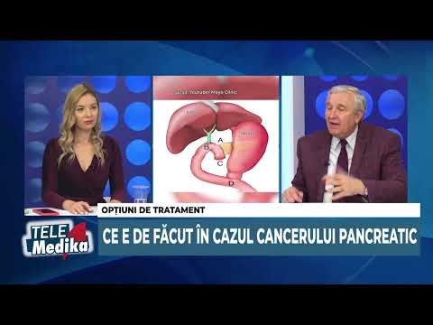 Video: Etapa 4 Cancerul Pancreatic: Tratament și Perspective