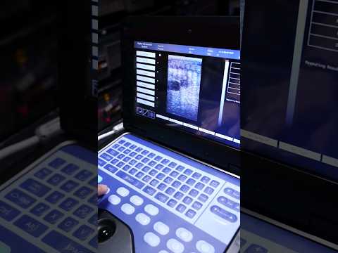 Ultrasoundงูทำแบบไหนballpyt Ultrasoundงูทำแบบไหนballpyt