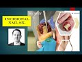 Video - brief overview of incisional nail surgery