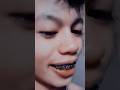 Brace. #funny #comedy #trending #shorts