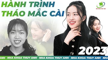 Vlog Tháo Mắc Cài Của Thanh Tâm Sau 2 Năm Niềng Răng