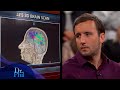 Brain Scan Reveals Man’s Brain Shrank