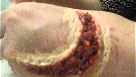 Applying Prosthetics - Part 1