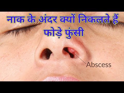 नाक अपने घर में व्यवहार करने के लिए शुभांगी वर्मा