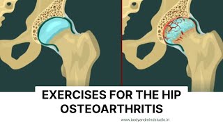 Hip Osteoarthritis Exercises | Improve Mobility & Reduce Pain Naturally
