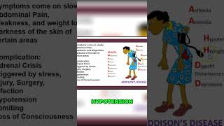 Addison Disease Signs: MEHD2 Symptoms I Unveiling Abdomen Pain and Weakness #shorts