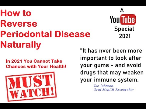 How To Naturally Cure Periodontal Disease With Oil Pulling How To Naturally Cure Periodontal Disease With Oil Pulling