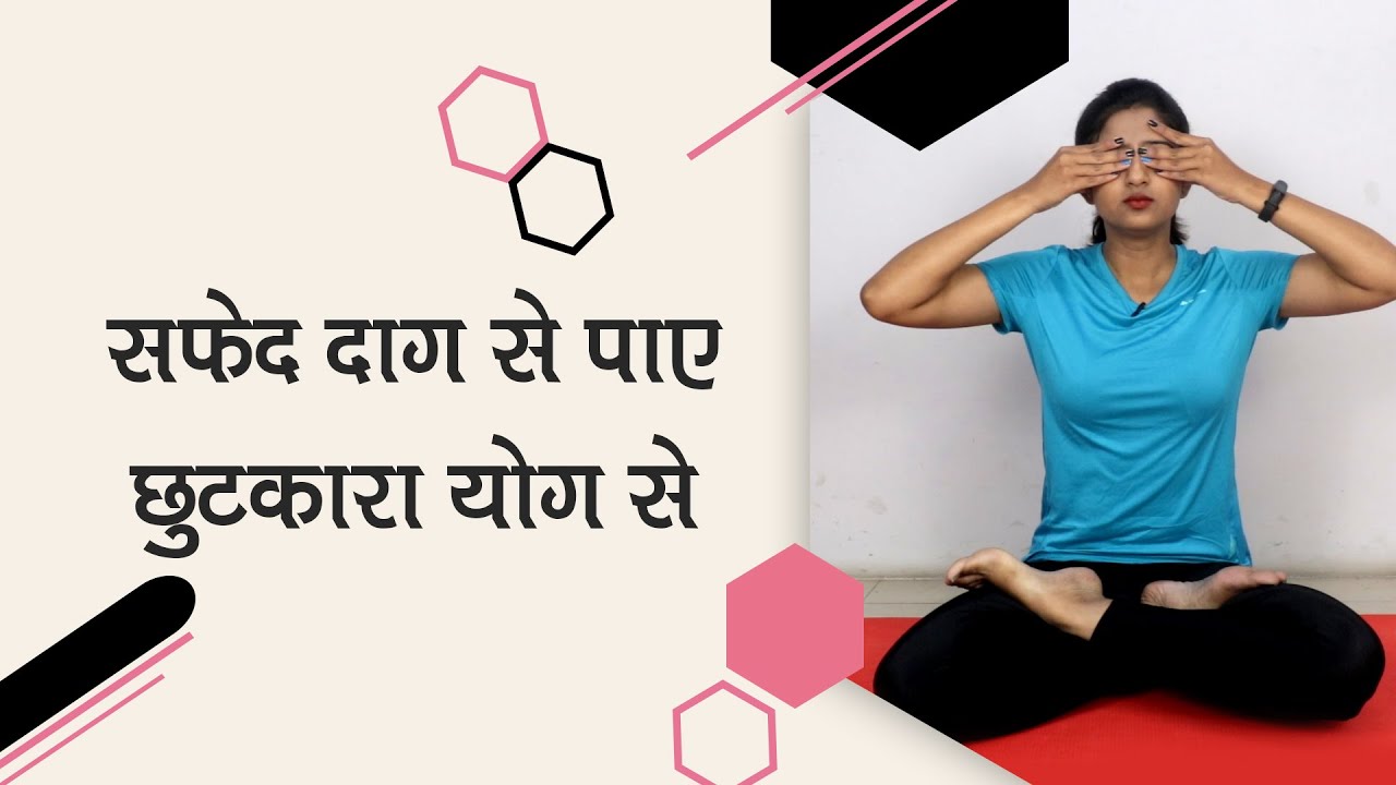 Yoga for Vitiligo सफेद दाग के लिए योग YouTube
