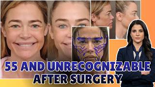 Denise Richards shares wild before-and-after photos of shocking facelift transformation