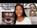 TURKEY ZIRCONIUM PORCELAIN CROWNS EXPERIENCE & GUM CONTOURING | DR EBRU CATAL HOCAOGLU. THE CLINIQUE