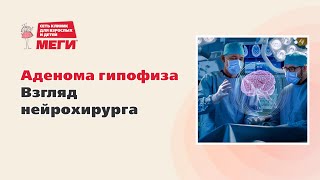 Аденома гипофиза — взгляд нейрохирурга. Азат Амирович Зайнагов.