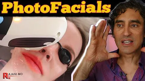 PHOTOFACIAL // HOW MANY IPL TREATMENTS