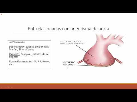 Vídeo: Aorta Abdominal: Ramas, Aterosclerosis, Ruptura