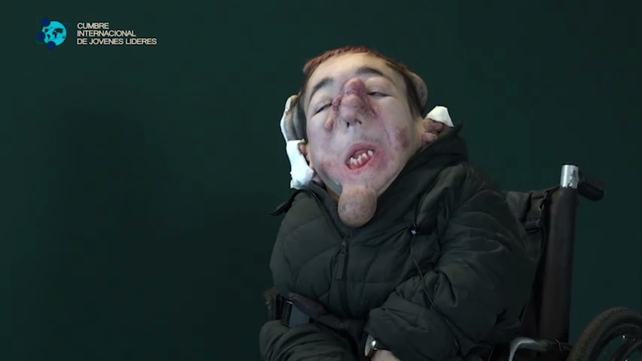 El hombre que vive en un cuerpo ilegal | Matías Burzaco | CJL