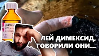 ДИМЕКСИД & МАСЛОЖОР // А оно вам надо? // Раскоксовка двигателя