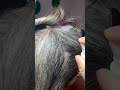 liceinfestation275 #headliceremoval #licecomb #headlice #headlicetreatment #hairlice #haircare #hair